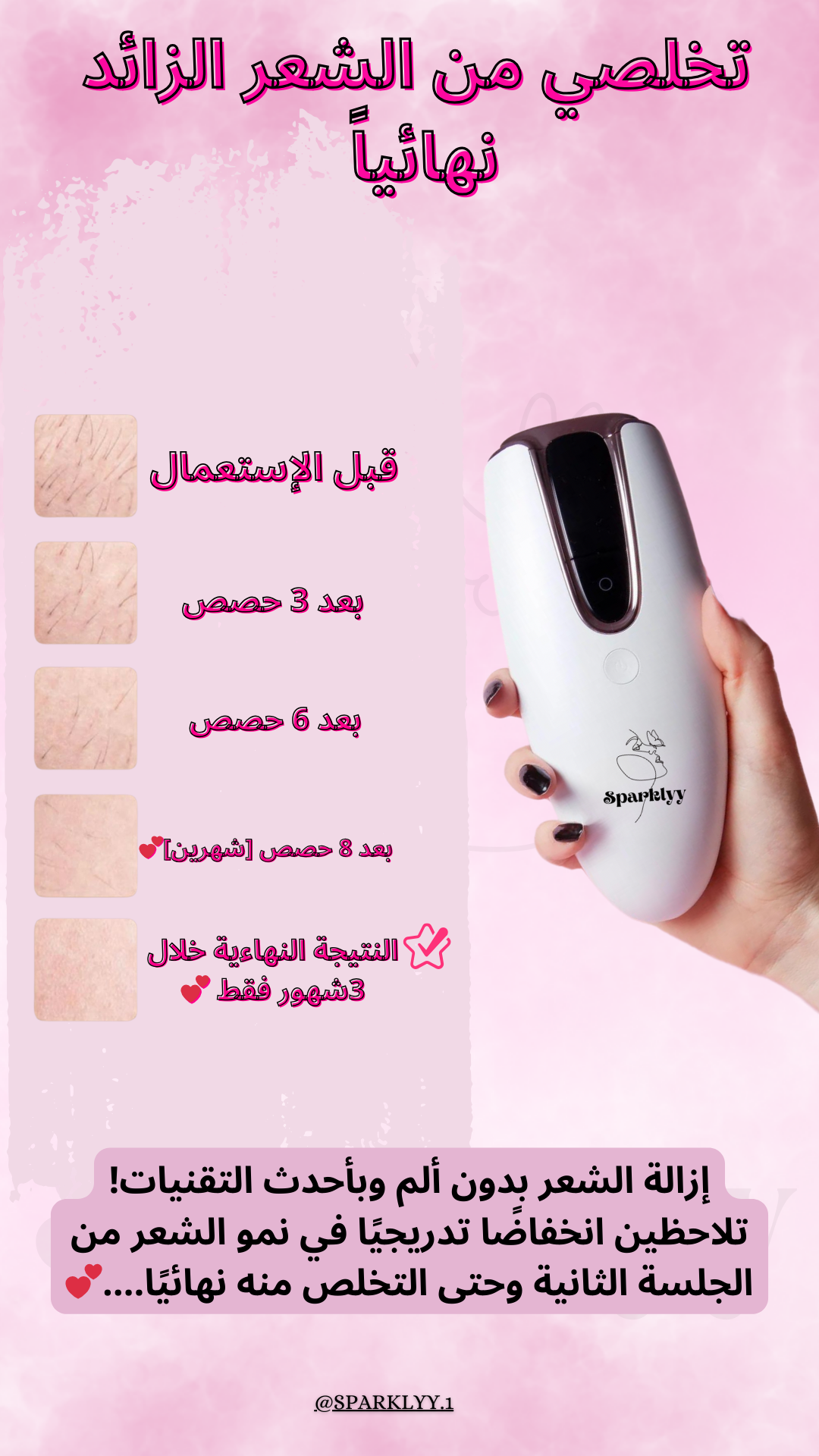 Sparklyy-IPL